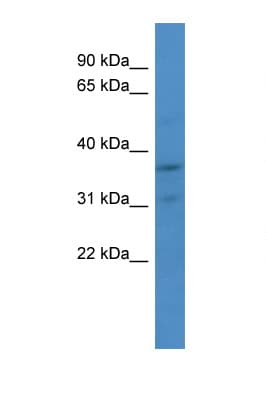 CDK2 Antibody (aa123-172)