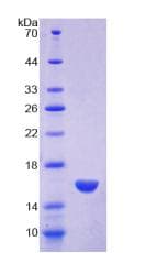 Human MPO / Myeloperoxidase Protein (Recombinant His)