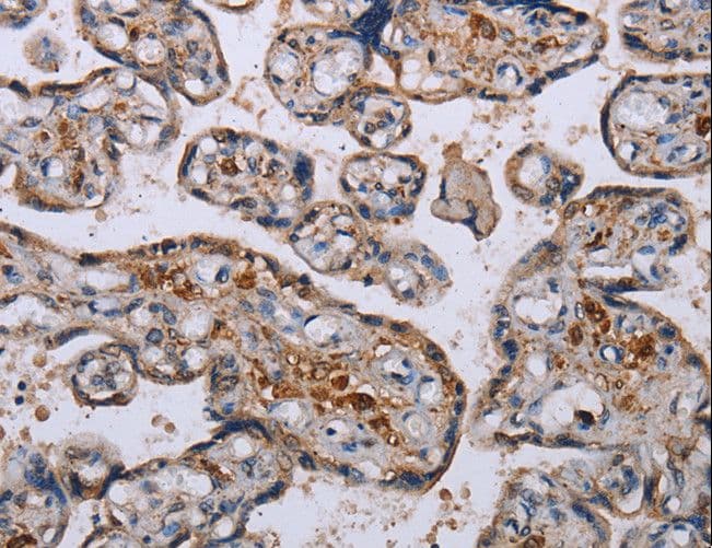 Polyclonal Rabbit anti-Human P3H3 / LEPREL2 Antibody (IHC, WB)