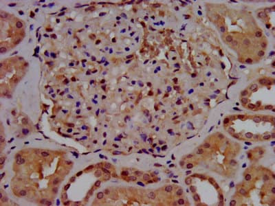 SLC7A1 / CAT1 Antibody