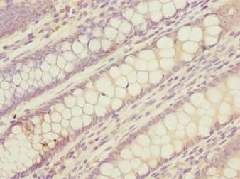 LMO4 Antibody