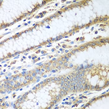 Polyclonal Rabbit anti-Human PDIA3 / ERp57 Antibody (IHC, WB)