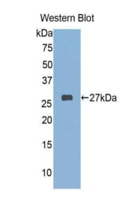 FKBP25 / FKBP3 Antibody (aa2-224)