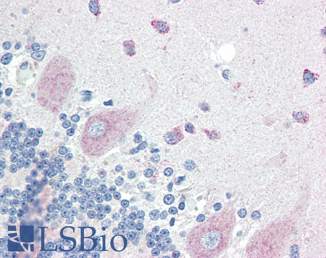 IHC-plus™ SLITRK6 Antibody