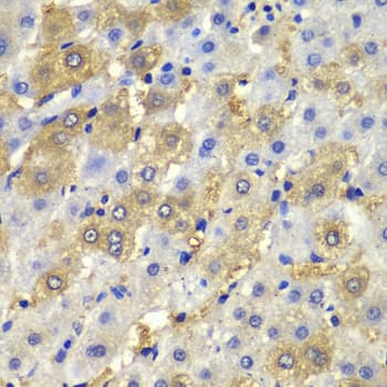DSP / Desmoplakin Antibody