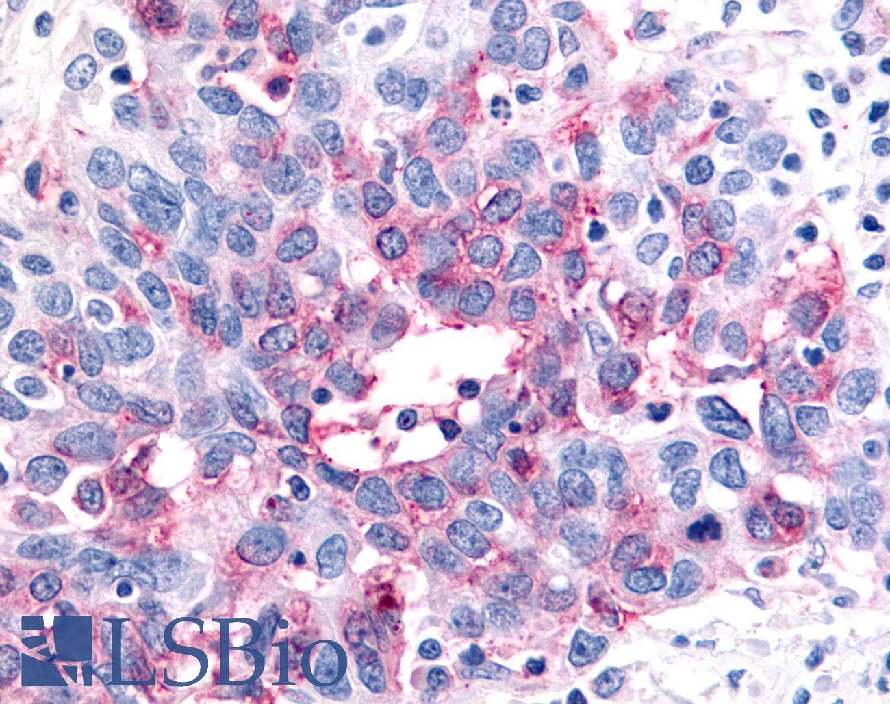PathPlus™ Polyclonal Rabbit anti-Human P2RY12 / P2Y12 Antibody (N-Terminus, IHC)