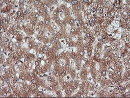 MAP2K1 / MKK1 / MEK1 Antibody (clone OTI8A6, Carrier-free)