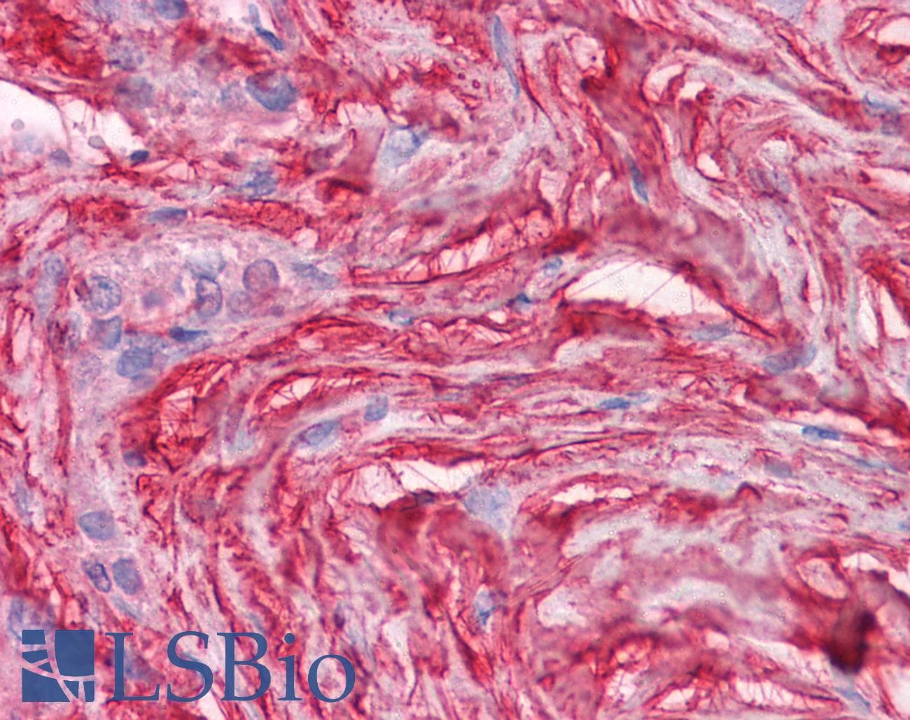IHC-plus™ DCN / Decorin Antibody (clone 3H4-1F4)