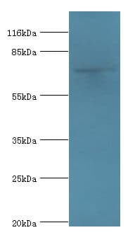 MTMR7 Antibody (aa1-660)