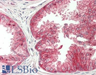 IHC-plus™ JUP/CTNNG/Junction Plakoglobin Antibody (aa695-745)