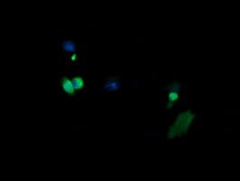 MAP2K3 / MEK3 / MKK3 Antibody (clone OTI6F8)