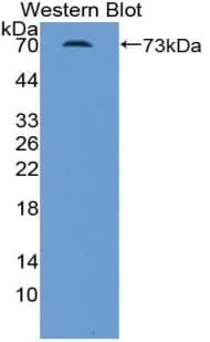 INHBB / Inhibin Beta B Antibody (aa50-404)