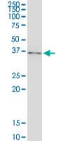 NFKBIA / IKB Alpha / IKBA Antibody (clone 3H4)