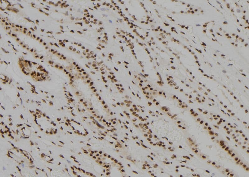 MED22 Antibody