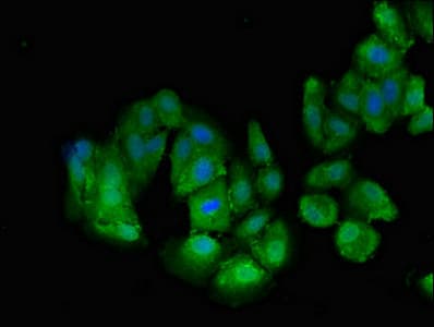 Transportin-SR / TNPO3 Antibody