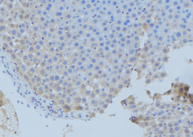 Polyclonal Rabbit anti-Human DBI / ACBD1 Antibody (IHC, WB)