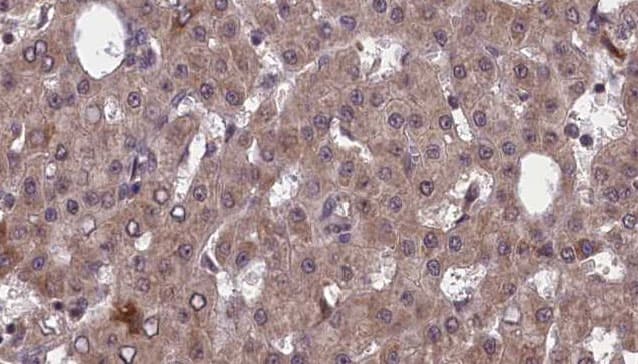 PVRL2 / CD112 Antibody