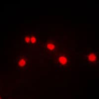 Polyclonal Rabbit anti-Human DYRK / DYRK1A Antibody (N-Terminus, IHC, IF, WB)