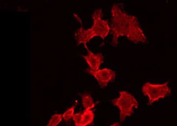 UBE3B Antibody