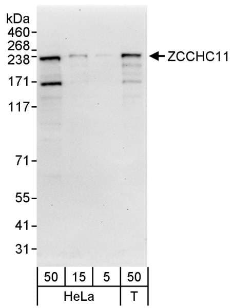 Polyclonal Rabbit anti-Human KIAA0191 / ZCCHC11 Antibody (aa1-50, WB)