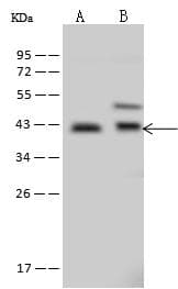 SERPINB6 / PI-6 Antibody