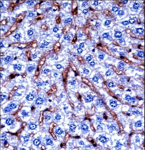 DYRK2 Antibody (aa521-549)