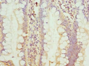 C8orf4 Antibody