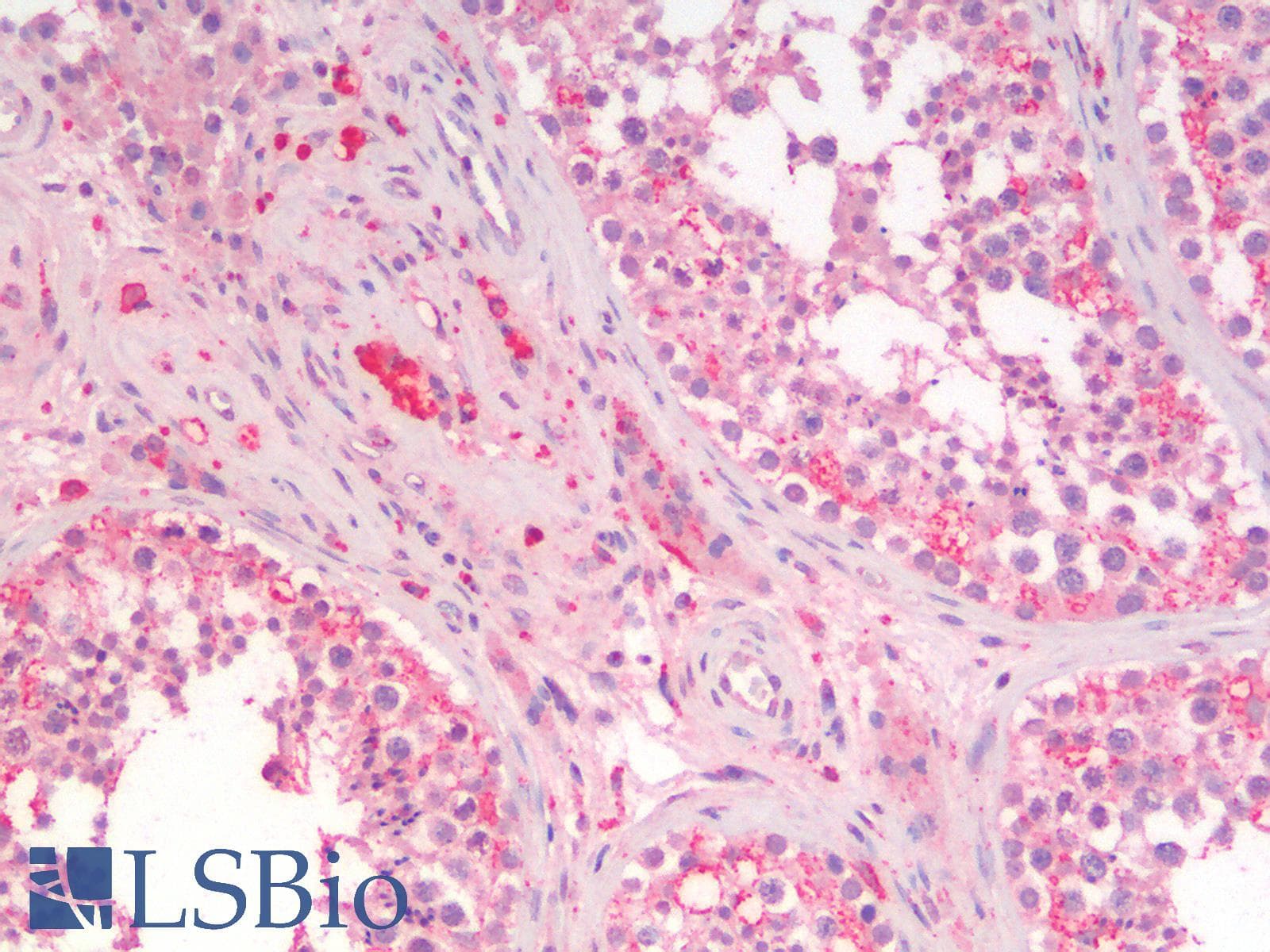 IHC-plus™ Polyclonal Goat anti-Human SGTA / SGT Antibody (Internal Region, IHC, WB)
