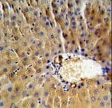 SERPINB3 Antibody (aa40-69)