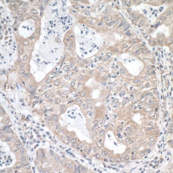 Polyclonal Rabbit anti-Human MTHFR Antibody (aa1-50, IHC)
