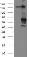 MEIS3 Antibody (aa1-261, clone OTI2E12, Carrier-free)