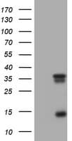 Monoclonal Mouse anti-Human TS / Thymidylate Synthase Antibody (clone OTI1D6, IHC, WB)