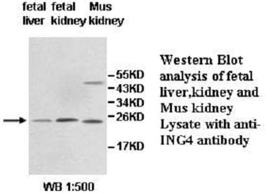 Polyclonal Rabbit anti-Human ING4 Antibody (aa33-183, IHC, WB)