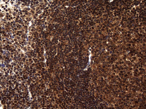 TSN / Translin Antibody (aa1-51, clone OTI1B5)
