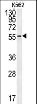 IHC-plus™ Polyclonal Rabbit anti-Human PAOX / PAO Antibody (aa467-496, IHC, WB)