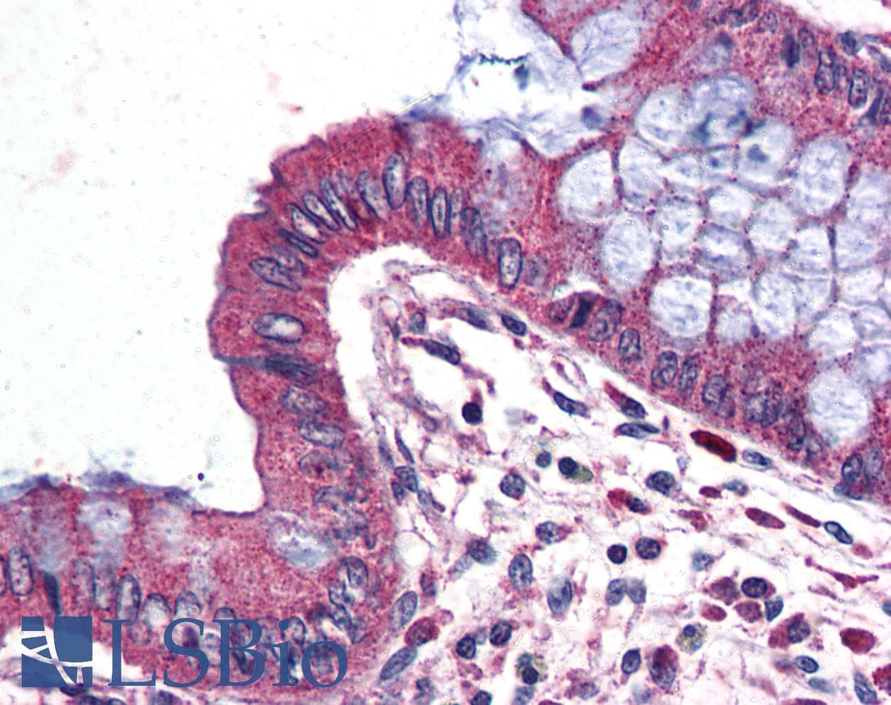 IHC-plus™ Polyclonal Rabbit anti-Human WNT14 / WNT9A Antibody (Internal, IHC)