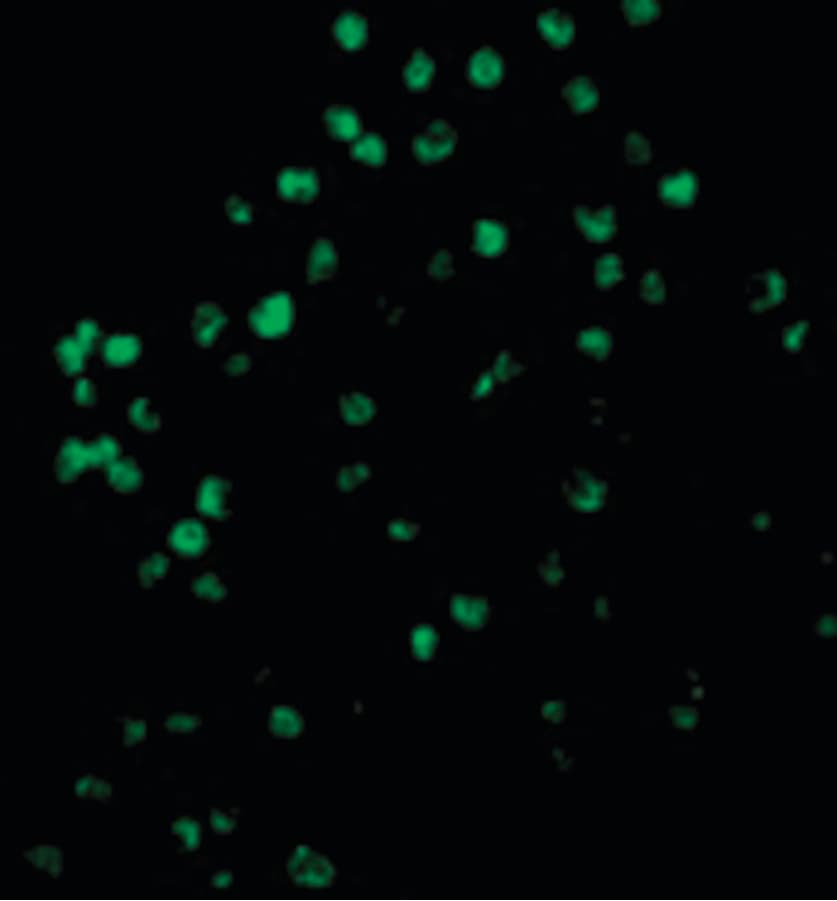IHC-plus™ CASP4 / Caspase 4 Antibody