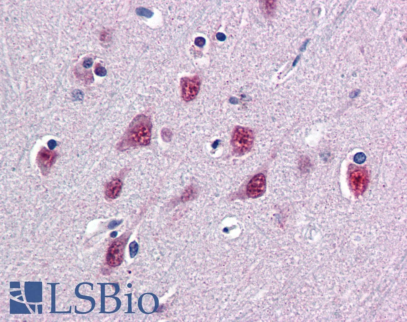 IHC-plus™ SMUG1 Antibody (aa2-14)