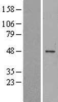 MAGEC2 / CT10 Protein (Over-Expression Lysate Myc-DDK (Flag))