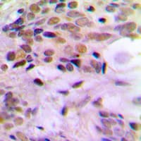 ERCC5 / XPG Antibody (N-Terminus)