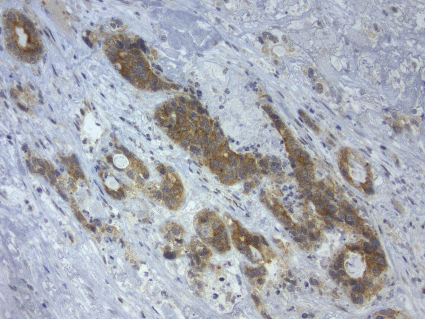 Monoclonal Mouse anti-Human GPR49 / LGR5 Antibody (clone UMAB212, aa22-543, IHC, IF, WB)