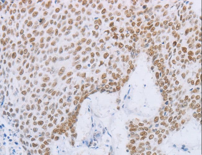MCM2 Antibody