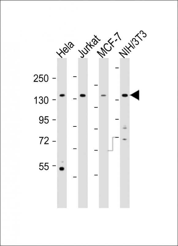 Polyclonal Rabbit anti-Human PLCG1 Antibody (aa758-790, WB)