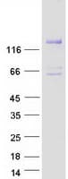 Human DGKeta / DGKH Protein (Recombinant Myc-DDK (Flag))