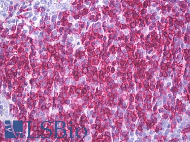 IHC-plus™ CD6 Antibody (clone MEM-98)