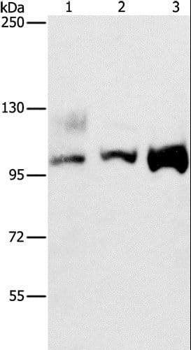 Polyclonal Rabbit anti-Human ASCC2 Antibody (WB)