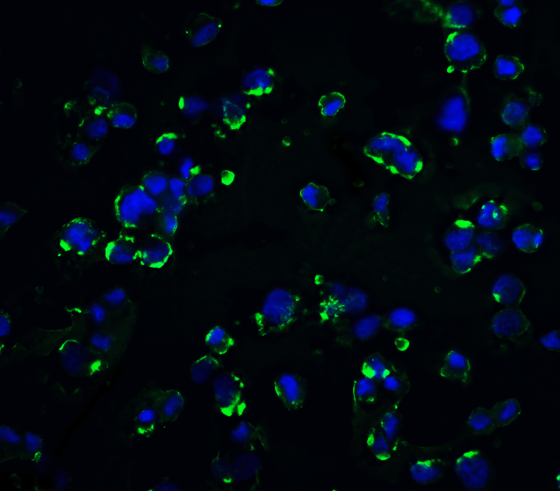 Polyclonal Rabbit anti-Human KIR2DS2 / CD158j Antibody (IF, WB)