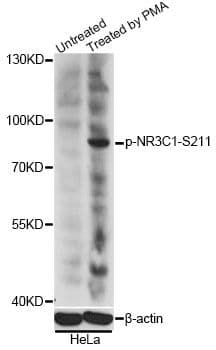 Polyclonal Rabbit anti-Human NR3C1/Glucocorticoid Receptor Antibody (phospho-Ser211, WB)