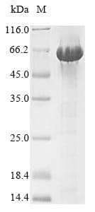 Mouse Serpina3n Protein (Recombinant 6His-SUMO, N-terminus)