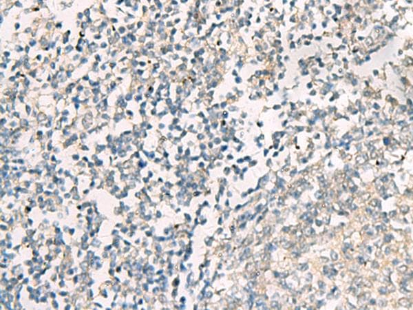 SERPINB4 / SCCA1+2 Antibody